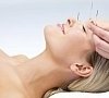 Акупунктура (рефлексотерапия, иглоукалывание), отдых все включено №7
