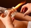 Вакуум-терапия, отдых все включено №3
