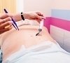 Гирудотерапия, отдых все включено №7