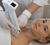 Карбокситерапия (газовые уколы), отдых все включено №8